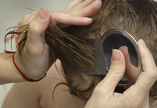 Начинать вычесывать вшей и гнид гребнем необходимо от самых корней волос