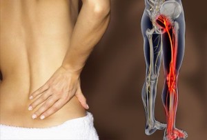 Что делать если боль в спине отдает в ногу?