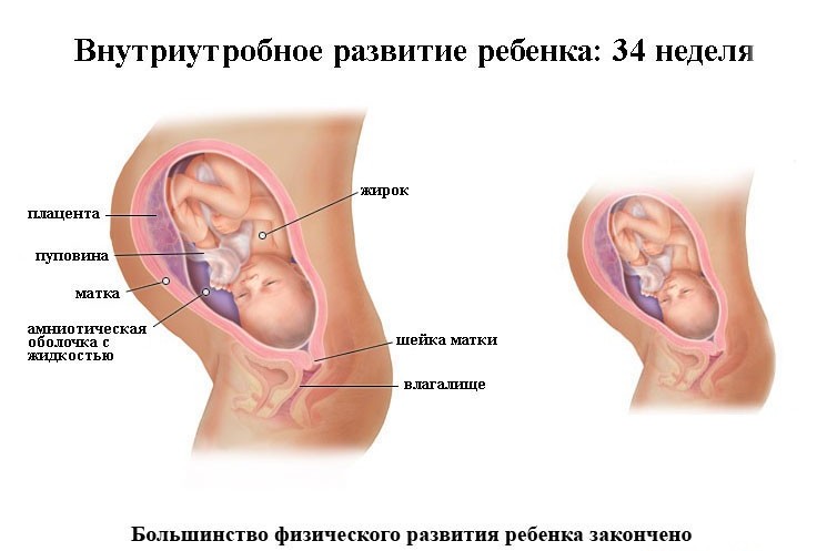 ребенок на 34 неделе беременности