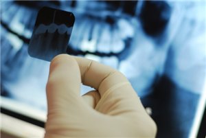 Рентген зубов во время беременности