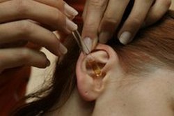 Как лечить уши, если их заложило