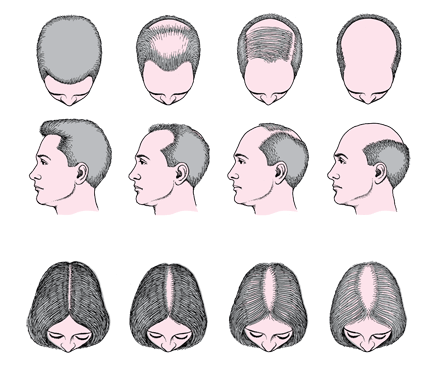 SKN_hair_loss