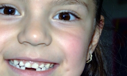 Все ли зубы меняются у детей