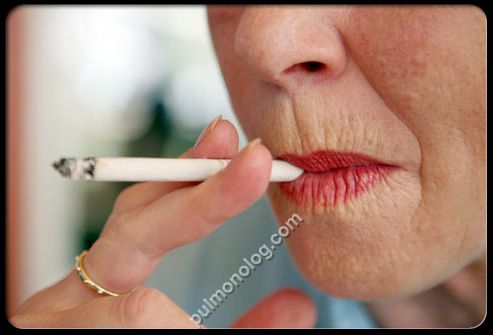 Линии вокруг губ при табакокурении