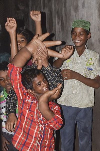Индийские врачи пытаются помочь мальчику с гигантскими руками