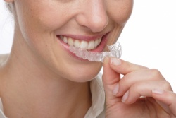 отбелить зубы в домашних условиях1